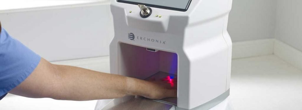 A Low-Level Laser Therapy (LLLT) Device for Fungal Nail Treatment
