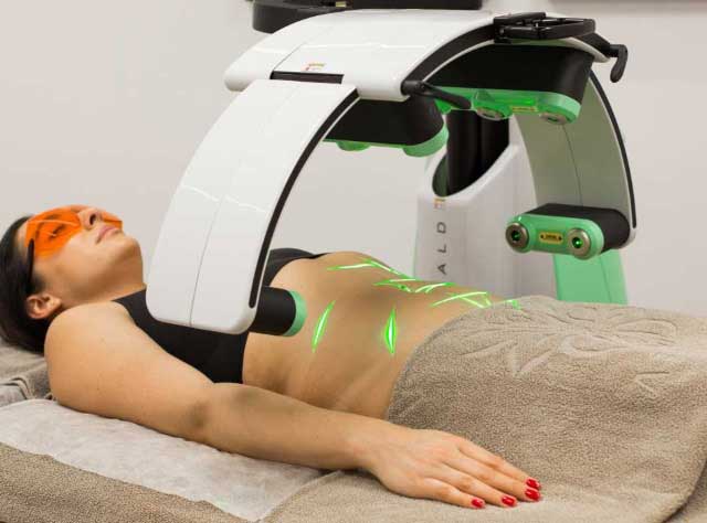 Emerald Laser For Fat Removal by Erchonia