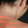 A woman being treated for back pain with a class 4 laser therapy device